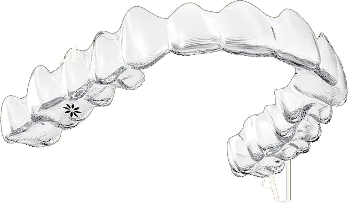 A clear aligner